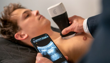 Detecting COVID-19 with Portable Ultrasound Network