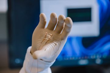 A prosthetic arm attached with a patch of ionic skin (credit: Kai Jacobson/UBC Faculty of Applied Science)